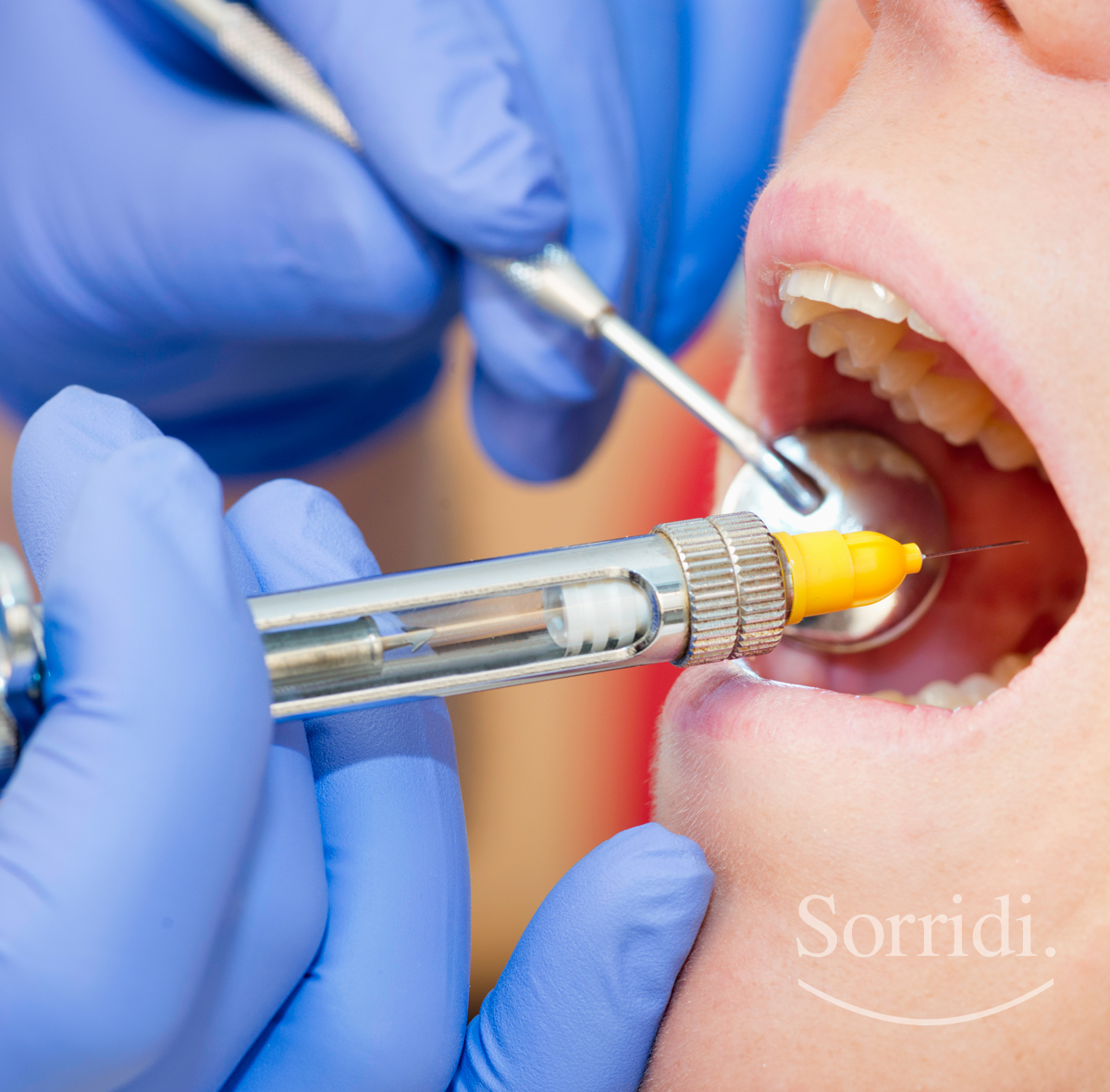 sorridi-ch-magazine-dentista-locarno-anestesia