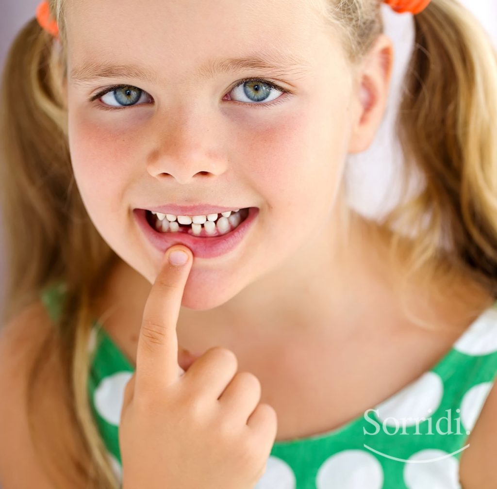 Caduta Denti Da Latte A 5 Anni Forum