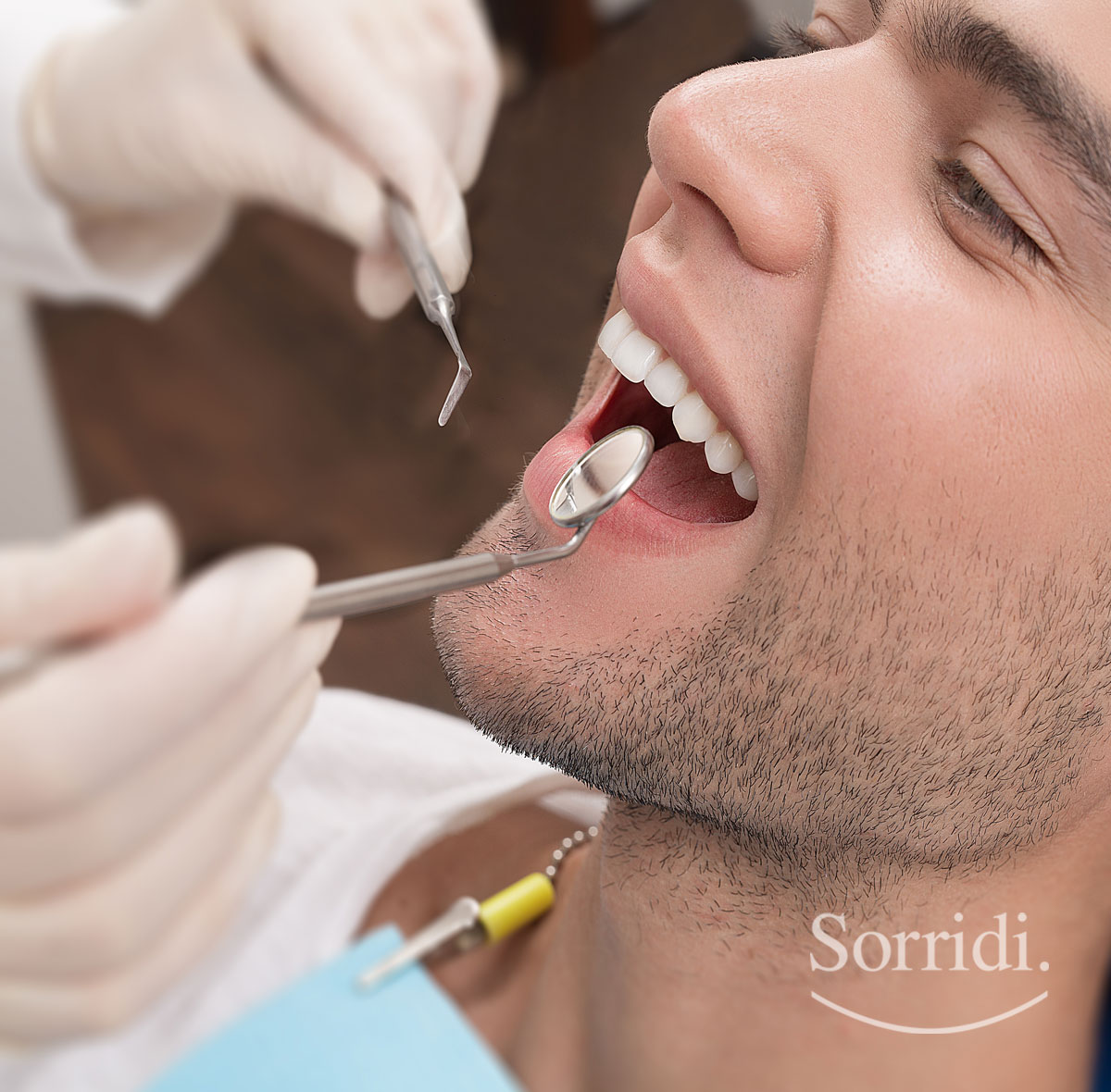 Sorridi-ch-magazine-apicectomia-dentale
