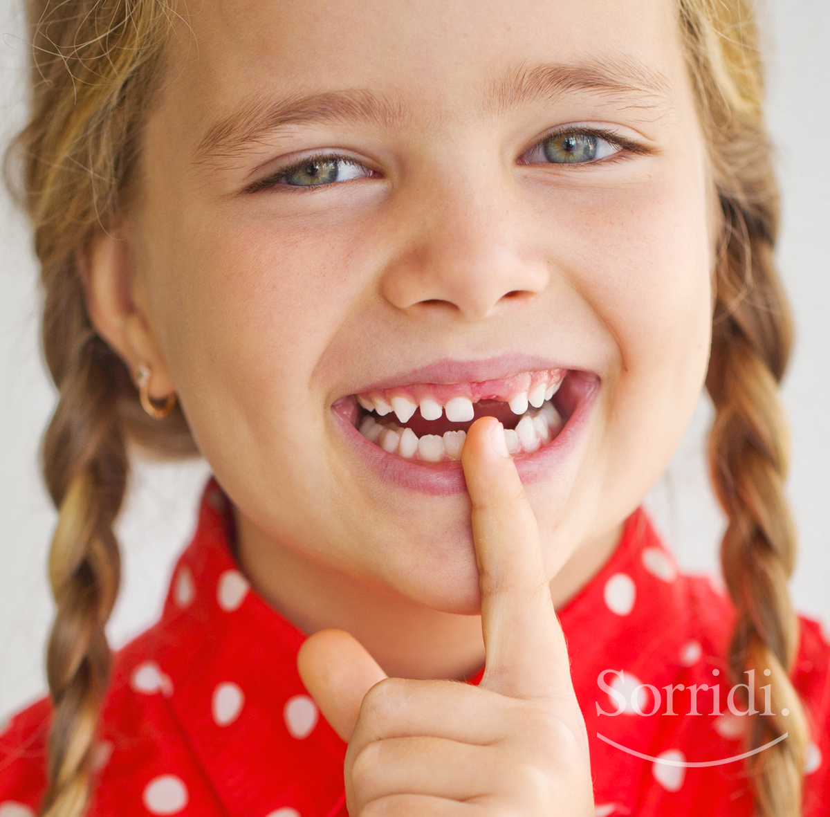 sorridi-ch-magazine-dentista-locarno-denti-da-latte-bambini