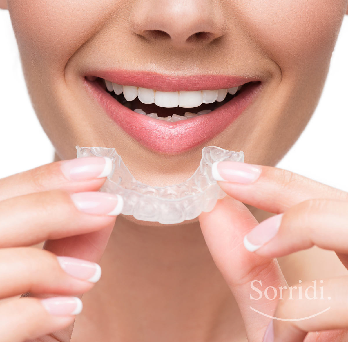 sorridi-ch-magazine-dentista-locarno-apparecchio-invisibile