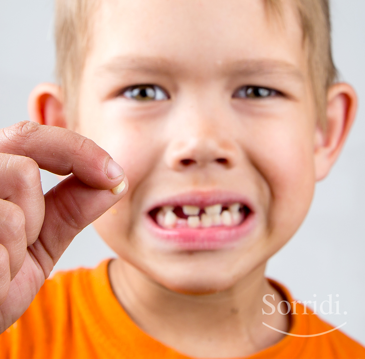sorridi-ch-magazine-dentista-locarno-denti-da-latte-rottura-bambini