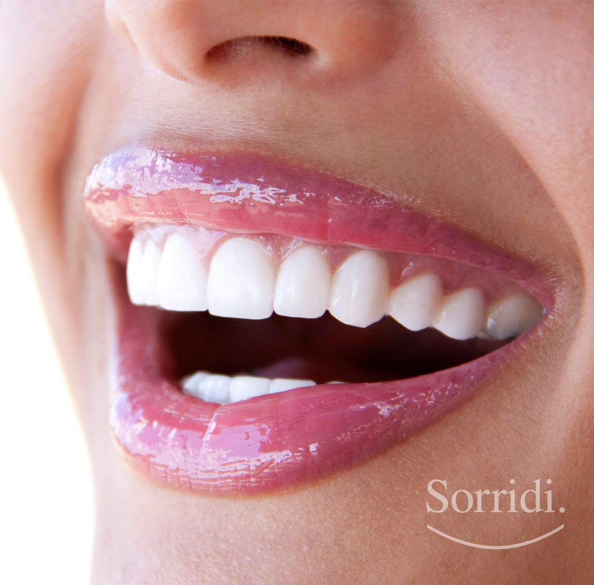 sorridi-ch-sbiancamento-dentale-magazine-dentista-locarno