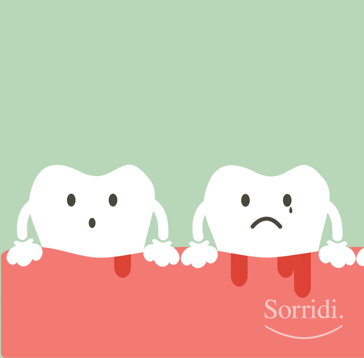 Sorridi-ch-magazine-curare-la-gengivite
