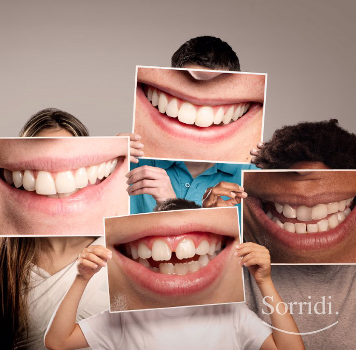 sorridi-ch-magazine-malocclusioni-dentali-di-bambini-e-adulti