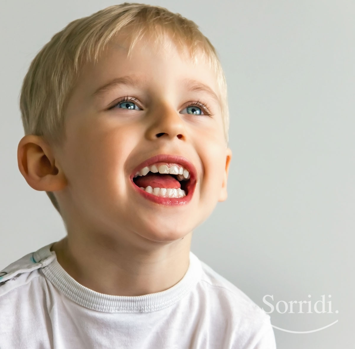 Sorridi-ch-magazine-vantaggi-della-sigillatura-dentale-nei-bambini