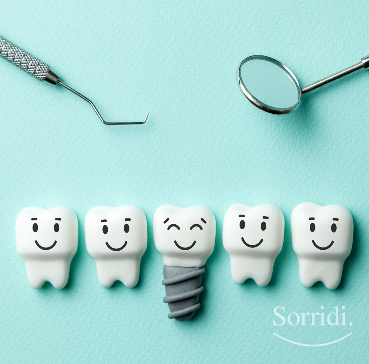 Sorridi-ch-magazine-implantologia-dentale-moderna