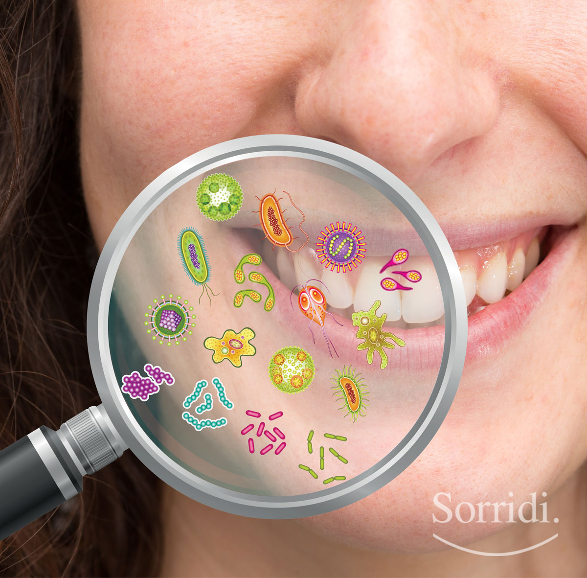 Sorridi-ch-magazine-placca-e-tartaro-nemici-dei-denti