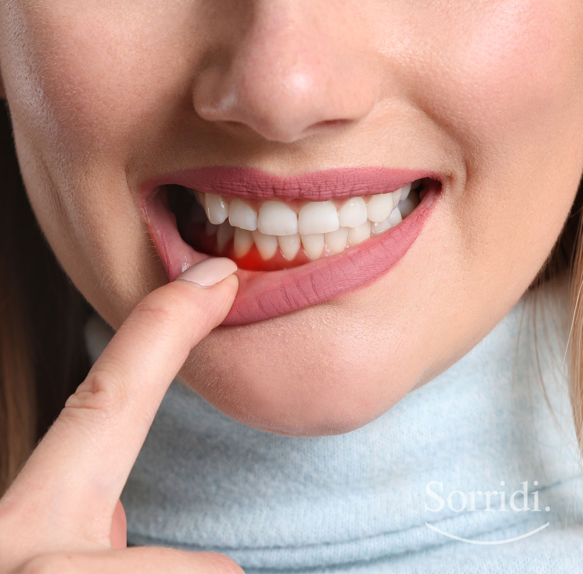 Sorridi-ch-magazine-diabete-e-parodontite