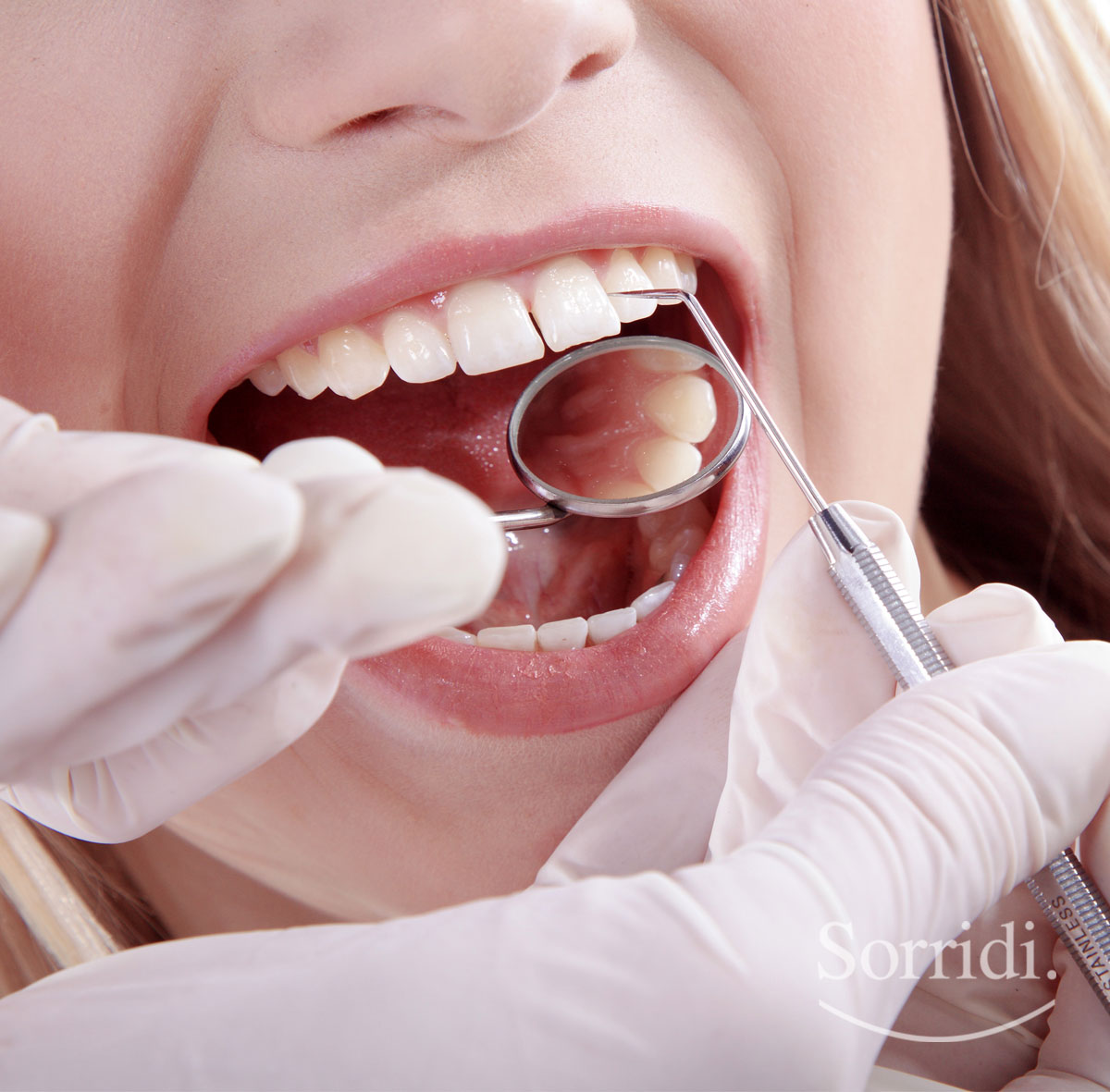 Sorridi-ch-magazine-fluoro-e-salute-dentale