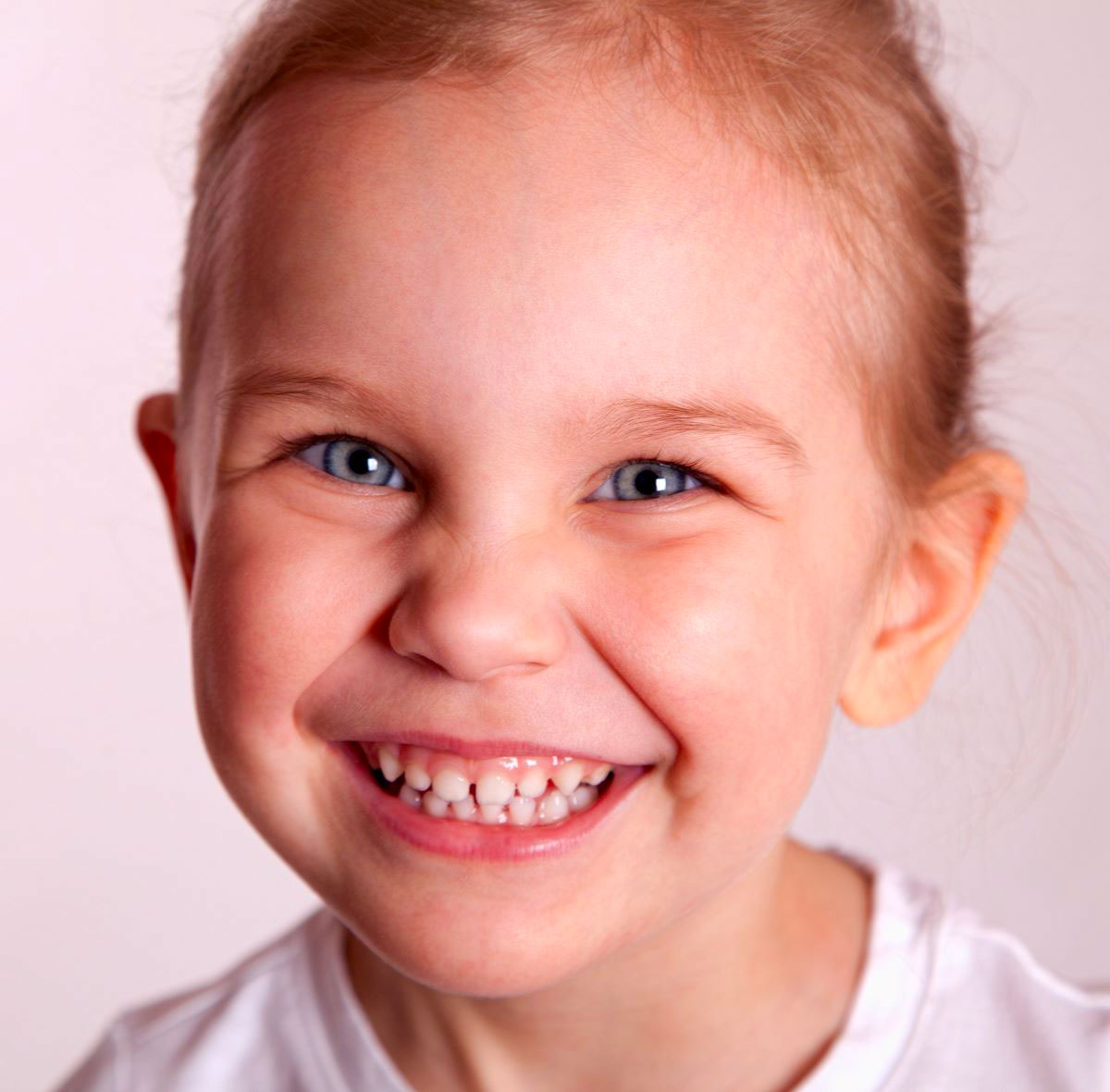 Sorridi-ch-magazine-evitare-che-i-denti-dei-bambini-crescano-storti