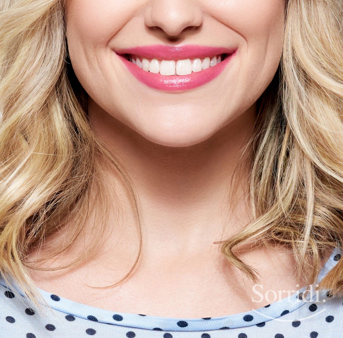 Sorridi-ch-magazine-estetica-dentale-per-migliorare-il-sorriso-velocemente