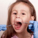 Sorridi-ch-magazine-sos-carie-bambini