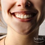 Sorridi-ch-magazine-sorriso-gengivale