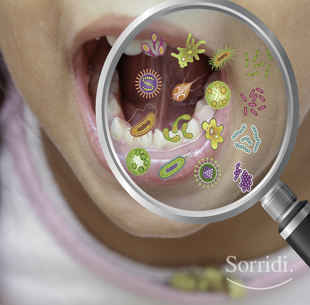 Sorridi-ch-magazine-guida-alle-infezioni-orali-nei-bambini